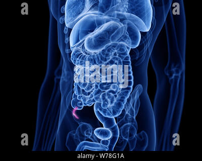 Medically Accurate Illustration Of The Appendix Stock Photo - Alamy