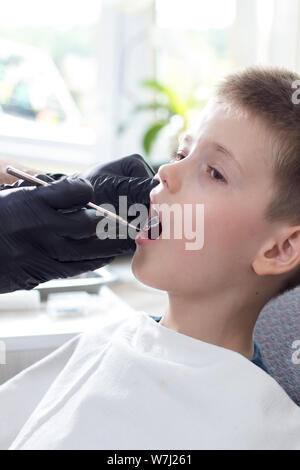 Dentist's hands in disposable black rubber gloves hold a dental mirror. The school-age boy sits on a chair with an open mouth. The doctor is watching Stock Photo