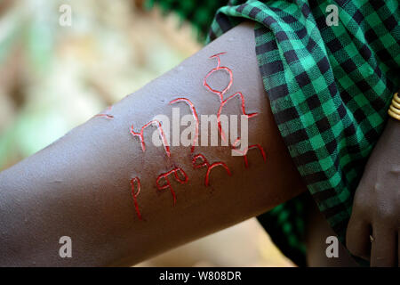 Young woman from the Bodi tribe displaying elaborate skin scarifications on her leg, her name in Amharic language, Omo Valley, Ethiopia, March 2015. Stock Photo