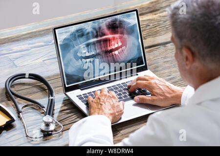 Close-up Of A Dentist's Hand Examining Teeth X-ray On Laptop Stock Photo