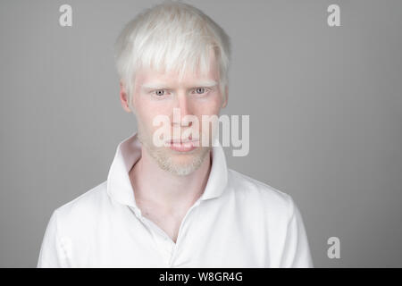 portrait of an albino man in  studio dressed t-shirt isolated on a white background. abnormal deviations. unusual appearance. skin abnormality Stock Photo