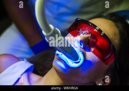 Face of a woman in a dental clinic doing teeth whitening Stock Photo