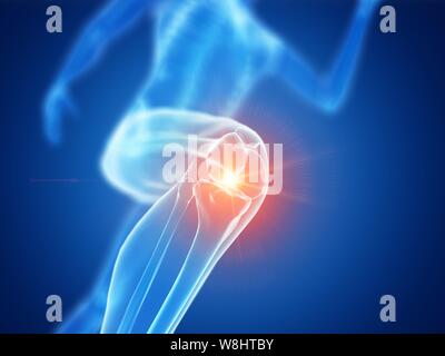 Runner with knee pain, conceptual computer illustration. Stock Photo