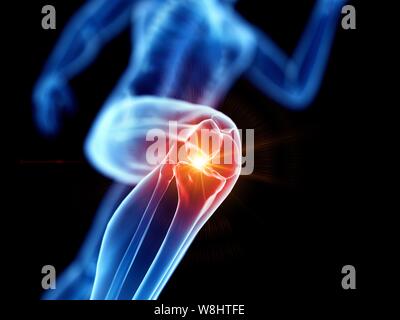 Runner with knee pain, conceptual computer illustration. Stock Photo