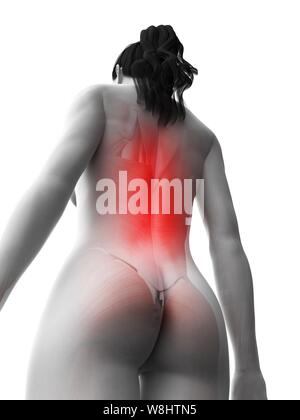 Back pain, conceptual computer illustration. Stock Photo