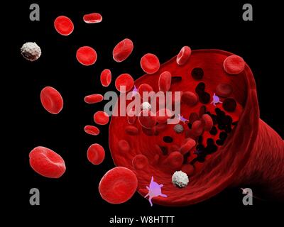 Blood vessel, computer illustration. Stock Photo