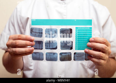 Image of male doctor or dentist holding and looking at old dental x-ray, analyzing Stock Photo