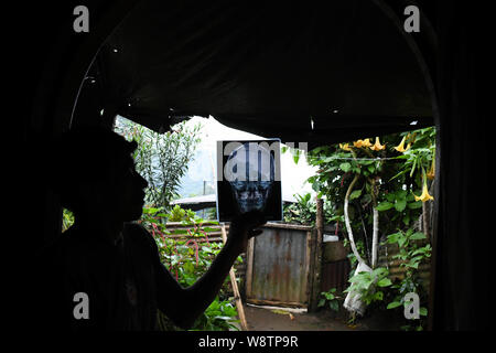 August 8, 2019, La Reforma, San Marcos, Guatemala: Edgar Perez, -father of Lisandro- shows a radiogram of his ill son Edgar Giovani in their one-room house in the neighborhood of Canton La Palma, in La Reforma, Guatemala. The parentsâ€” deep in debt from another sonâ€™s illness and now the smugglerâ€™s feeâ€” had pinned all their hopes on Lizardo making it to the U.S. Even as they now face losing their tiny house to creditors, they notice how Lisardo had finally escaped his permanent malnourishment during his 45 days in detention. â€œYou over took me Mâ€™ijo,â€ Edgar said.Â â€œLizardo is not Stock Photo