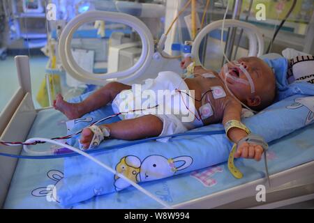 Peng Ankang, a baby whose weight was 0.8kg when he was born on June 17, is being treated in an incubator at the Louxing People's Hospital in Loudi cit Stock Photo