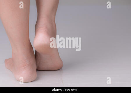 Healthcare and medical concept, Close up of Cracks on Heels with bad skin covered. Stock Photo