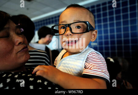 Junjun, who was born with a congenital facial cleft palate, is pictured at a hospital in Chongqing, China, 30 July 2012.   Junjun is a 1-year-old boy Stock Photo