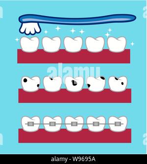 vector toothbrush over healthy and shiny teeth. dental tooth caries. orthodontic tooth brace. flat style icons Stock Vector