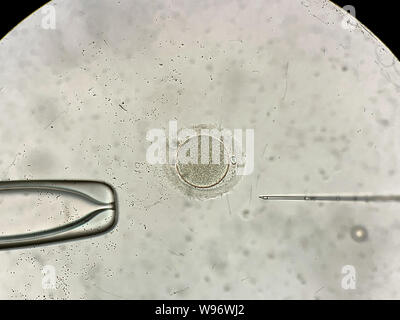 View through microscope at in vitro fertilization process Stock Photo ...