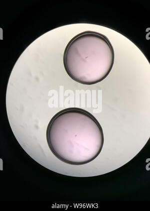 View through microscope at in vitro fertilization process Stock Photo ...
