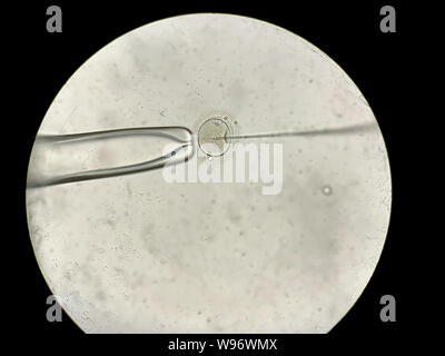 View through microscope at in vitro fertilization process Stock Photo ...