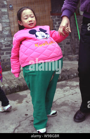 Hu Yunxing, a four-year-old girl whose abdomen measures 1.06 m in ...