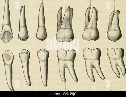 Molar teeth upper and lower right side number 13,14,18,19, and 20. one ...