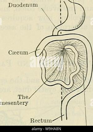 Archive image from page 1286 of Cunningham's Text-book of anatomy (1914). Cunningham's Text-book of anatomy  cunninghamstextb00cunn Year: 1914 ( DEVELOPMENT OF THE PEKITONEUM. 1253 abdomen is, as it were, caught in behind the stomach and lesser omentum. This portion of the cavity becomes the upper part (vestibule) of the omental bursa, and at first it communicates with the general cavity by a wide opening to the right of the lesser omentum; but the growth Stomach , ,. ,  Mesentery obliterated Median plane   v  Csecum | Median plane  Transverse mesocolon of the liver, encroaching upon the o Stock Photo