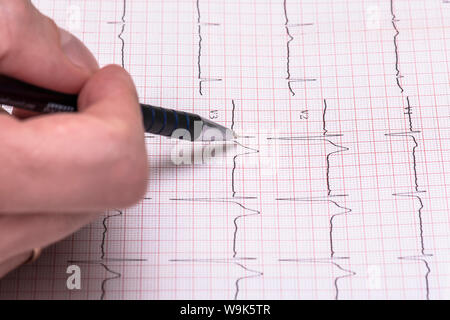 ECG paper graph report, electrocardiogram on paper form as background Stock Photo