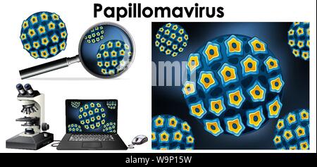 Papillomavirus virus on computer screen and magnifying glass illustration Stock Vector