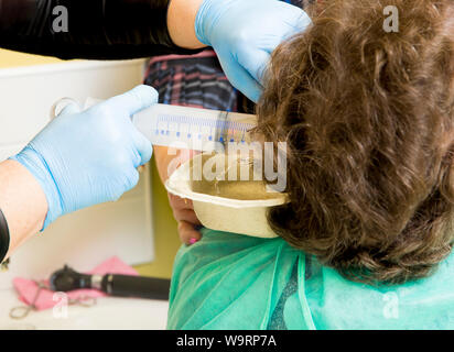 Doctor performing medical treatment, removing patient earwax with pushing water in ear with big medical syringe. Hearing loss concept. Stock Photo