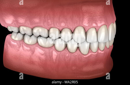 Healthy human teeth with normal occlusion, 3D Illustration Stock Photo ...