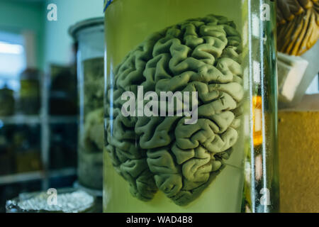 Human brain in glass jar with formaldehyde for medical studies. Stock Photo