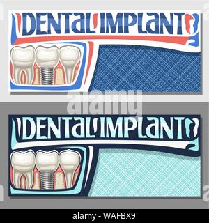 Vector banners for Dental Implant with copy space, layouts with 3 cartoon human teeth in jaw, invitation with lettering dental implant, sign board for Stock Vector