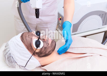 Procedure carbon facial peeling in the clinic of laser cosmetology. Stock Photo