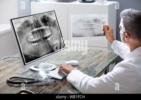 Close-up Of A Dentist's Hand Examining Teeth X-ray On Computer Stock Photo