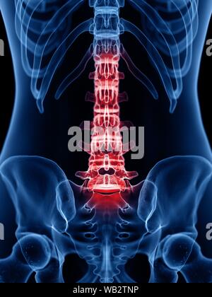 Back pain, conceptual illustration Stock Photo