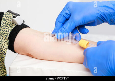 Close-up shot of doctor or nurse taking a blood sample from arm vein with a vacutainer. Venipuncture or venepuncture procedure Stock Photo