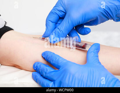 Close-up shot of doctor or nurse taking a blood sample from arm vein with a vacutainer. Venipuncture or venepuncture procedure Stock Photo