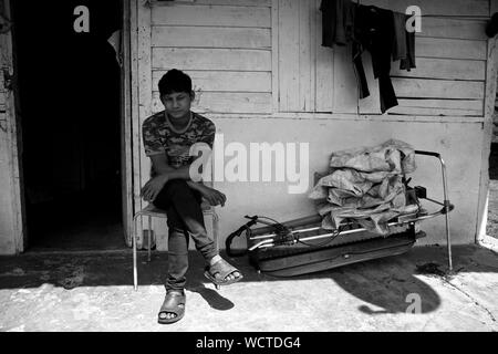 Bharat Tea Estate, Cameron Highland, Malaysia: Roopnarayan of age 30 is from Navalparasi, near Bhutval, Nepal. He has been working here for over 2.5 years. He lost half his finger in leaf cutting machine (Plucking machine) in December 2016. At the time, the company paid for his medical expense, which was later deducted from his salary once he received insurance from the government.  'I paid NPR 1,40,000 to manpower to come and work here. I am only able to ear about 800-900 MYR/month. Here you have to buy your own equipment, which cost 3000 MYR. I had to buy it twice as my first one was spoilt. Stock Photo