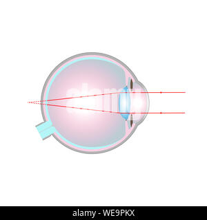 Shorty and Long Sightedness Stock Vector Art & Illustration, Vector ...