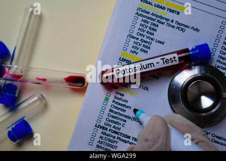 Potassium - Test with blood sample. Top view isolated on office desk. Healthcare/Medical concept Stock Photo