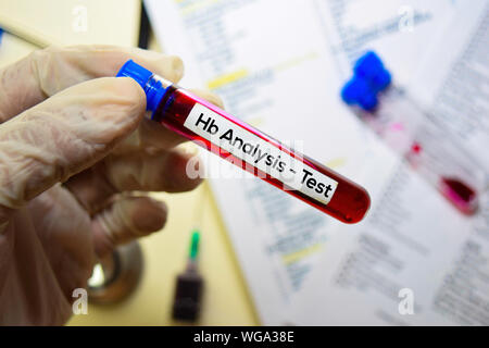 Hb Analysis - Test with blood sample. Top view isolated on office desk. Healthcare/Medical concept Stock Photo