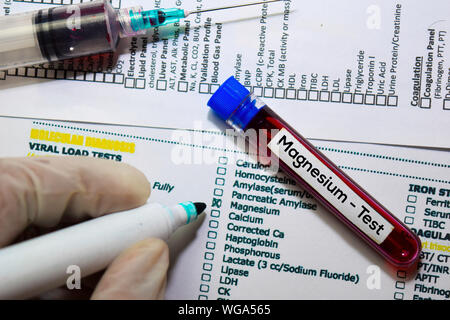 Electrolyte - Test with blood sample. Top view isolated on office desk ...