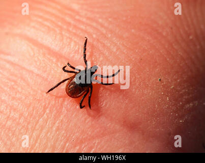 Female castor bean tick, Ixodes ricinus, walking on the human skin and searching for blood meal. Stock Photo