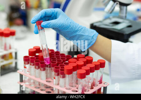 Focused photo on reagent that being in test tube Stock Photo