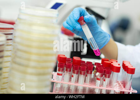 Focused photo on female hand that checking reagent Stock Photo