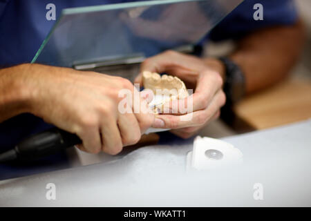 The hands of a dental technician in the process of manufacturing an individual denture Stock Photo
