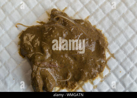feces with Toxocara cati from a stray cat Stock Photo