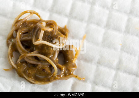 feces with Toxocara cati from a stray cat Stock Photo