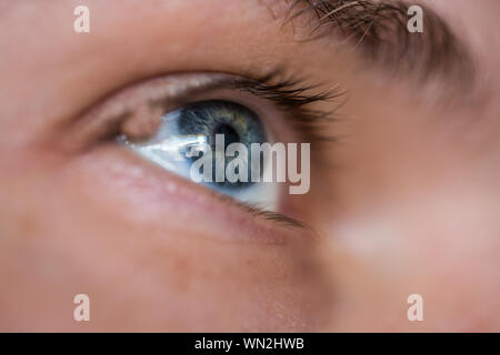 Eye with mole in macro picture. Stock Photo