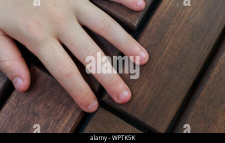 Bitten fingernails - bitten fingers. Close up of hands with bitten finger and fingernails Stock Photo