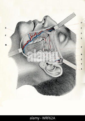 Surgery and medicine - cheek region: suborbital, preauricolar and buccomandibular zonee exposed with facial musculature, facial artery and vein Stock Photo