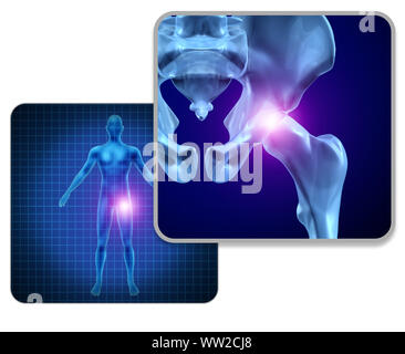 Human hip joint pain concept as skeleton and muscle anatomy of the body with sore joints as a painful injury or arthritis illness symbol for health. Stock Photo