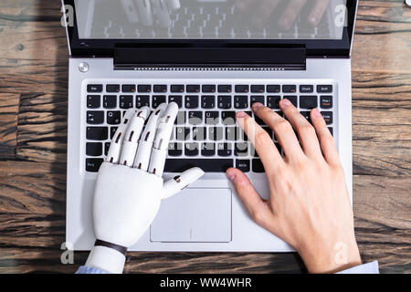 Man With Prosthetic Hand Working On Laptop. Artificial Limb Stock Photo