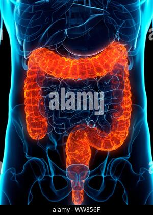 Inside of an unhealthy colon Stock Photo - Alamy